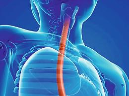 Un esofago bioartificiale totalmente frutto dell'ingegno di due siciliani
