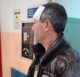 Catania, vigile urbano picchiato in centro storico: dito rotto e un mese di prognosi