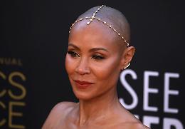 Malattia moglie Will Smith, cos'è l'alopecia e e da cosa è provocata