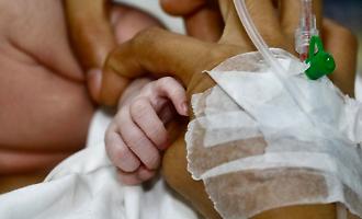 Nascita eccezionale a Palermo: il primo bambino portatore di glicogenosi 1A e 1B