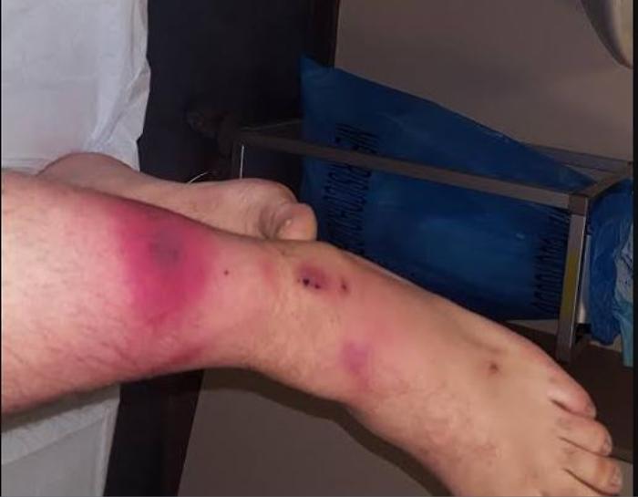 Il mare dello Stretto di Messina &egrave; super vigilato, c'&egrave; la presenza di un batterio che ha fatto gi&agrave; registrare vittime